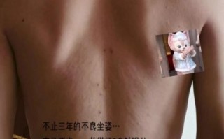 挑羊毛疔非物质文化遗产(挑羊毛疔是国家级非遗吗) 挑羊毛疔非物质文化遗产(挑羊毛疔是国家级非遗吗)