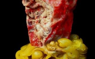 鸡血石非物质文化遗产（鸡血石非遗技艺是什么）