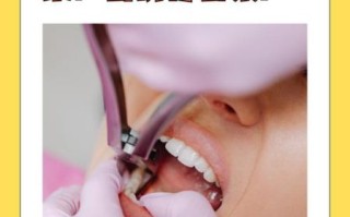 非物质文化遗产拔牙（民间非遗拔牙技艺是否安全）