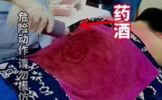 非物质文化遗产熨氏疗法（熨氏疗法怎么自己在家做）