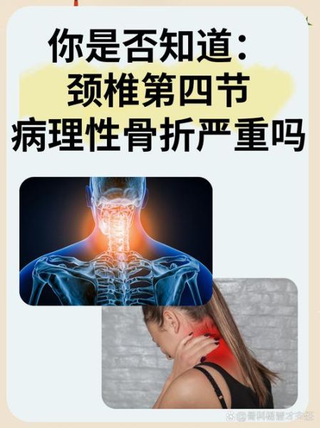 颈椎非物质文化遗产是啥(颈椎非物质文化遗产是哪个项目)-第2张图片-八三百科 颈椎非物质文化遗产是啥(颈椎非物质文化遗产是哪个项目)-第2张图片-八三百科