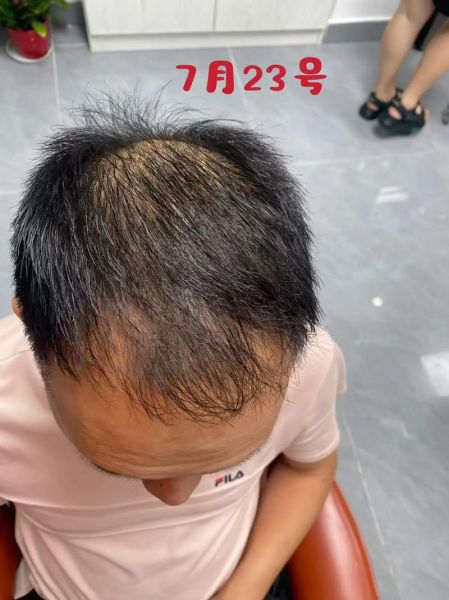 生发非物质文化遗产(生发非遗是真的吗)-第2张图片-八三百科 生发非物质文化遗产(生发非遗是真的吗)-第2张图片-八三百科