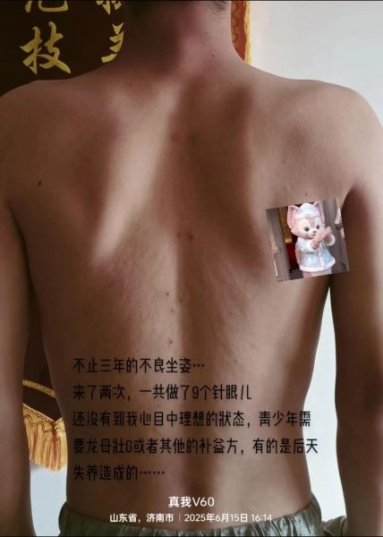 挑羊毛疔非物质文化遗产（挑羊毛疔是国家级非遗吗）-第1张图片-八三百科