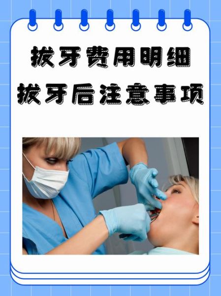 非物质文化遗产拔牙（民间非遗拔牙技艺是否安全）-第2张图片-八三百科