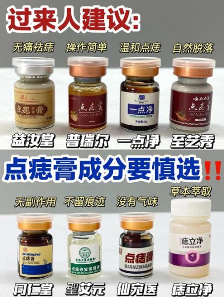 中药点痣非物质文化遗产（中药点痣是正宗非遗还是噱头）-第3张图片-八三百科