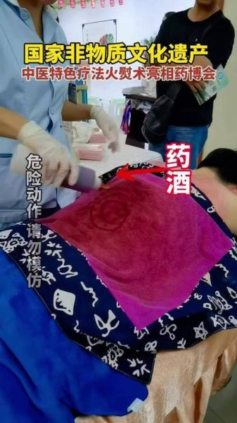 非物质文化遗产熨氏疗法（熨氏疗法怎么自己在家做）-第1张图片-八三百科