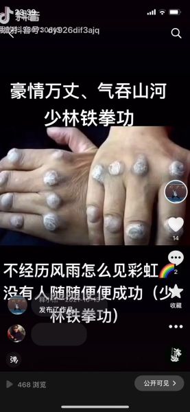 非物质文化遗产少林（少林非遗项目有哪些最新名录2025）-第2张图片-八三百科