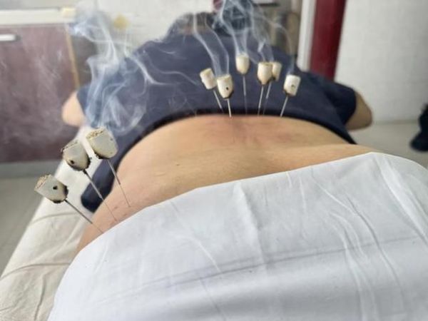 腰椎非物质文化遗产（腰椎非遗推拿有哪些项目）-第1张图片-八三百科